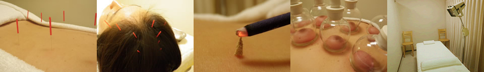 青山鍼灸院 aoyama acupuncture clinic